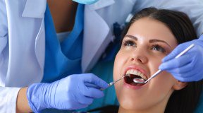 Igiene orale: gli errori da non fare