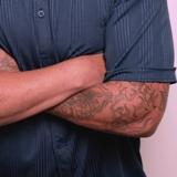 tatuaggio laser cancellare cicatrici colori