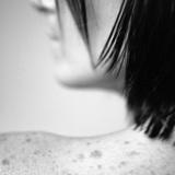 melanoma tumore della pelle microscopia confocale ipilimumab vemurafenib
