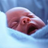 cardiochirurgia pediatrica, cardiopatie congenite