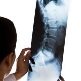 dolore cervicale, collo, braccia, ernia, trauma