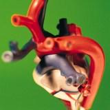 malattie cardiovascolari causa morte ischemia infarto