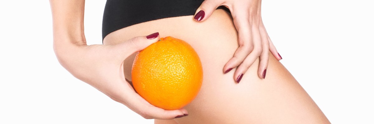 Cellulite: cosa fare per contrastare la pelle ‘a buccia d’arancia’