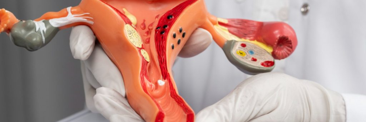 Endometriosi, nasce Endovision: un Manifesto per diagnosi precoci e migliori percorsi di cura