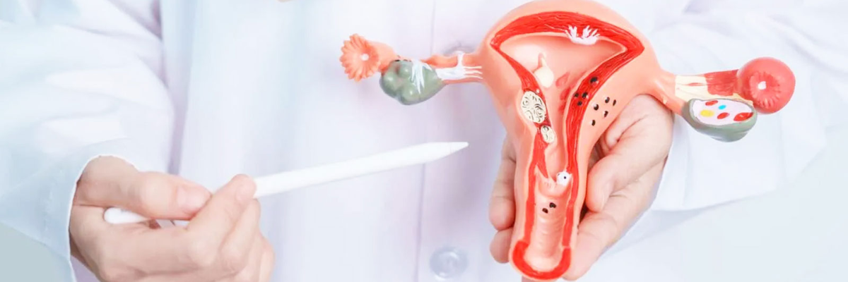 Sindrome dell’ovaio policistico, la dieta chetogenica migliora il metabolismo nel breve termine