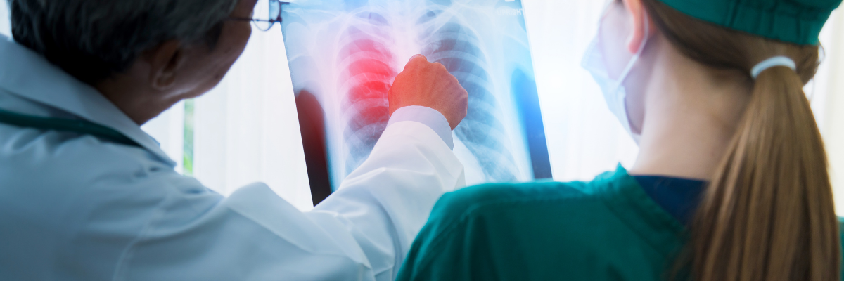 Minaccia tubercolosi, diagnosi rapide ma aumentano le forme resistenti