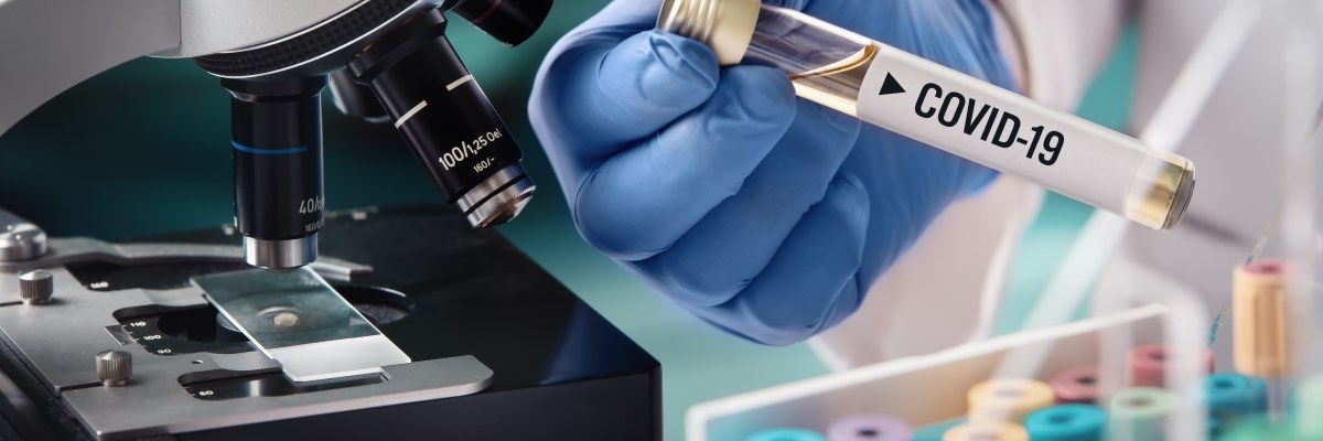 Covid-19: test diagnostici disponibili e dove effettuarli
