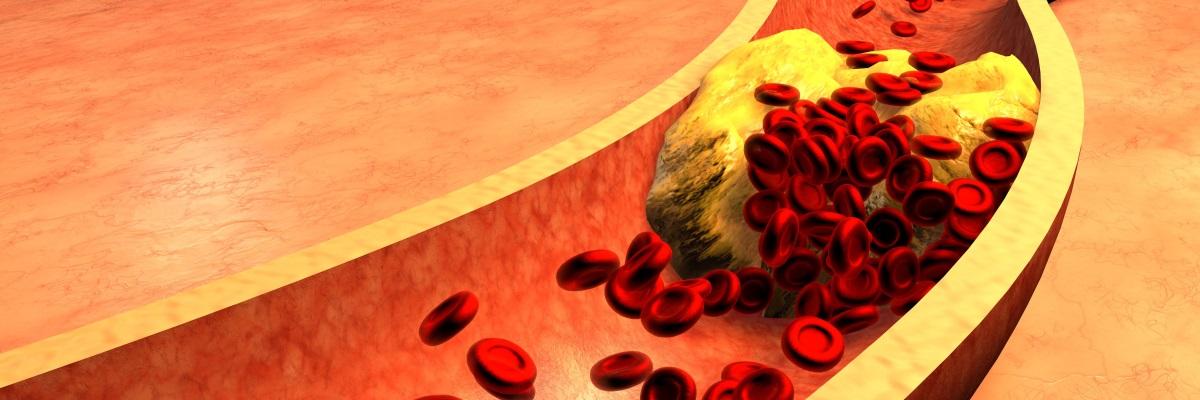 Nuovi farmaci contro il nemico colesterolo