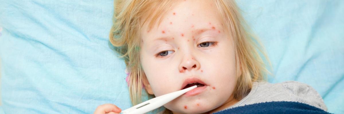 Morbillo e rosolia: migliora la sorveglianza con la rete MoRoNet