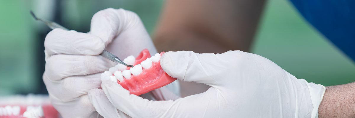 Protesi dentali: come tutelarsi da quelle fasulle