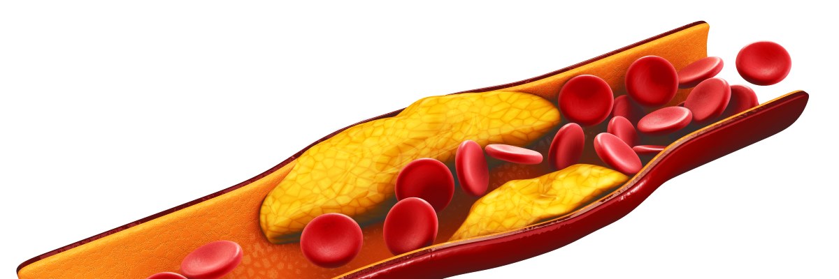 Integratori efficaci nella riduzione del colesterolo