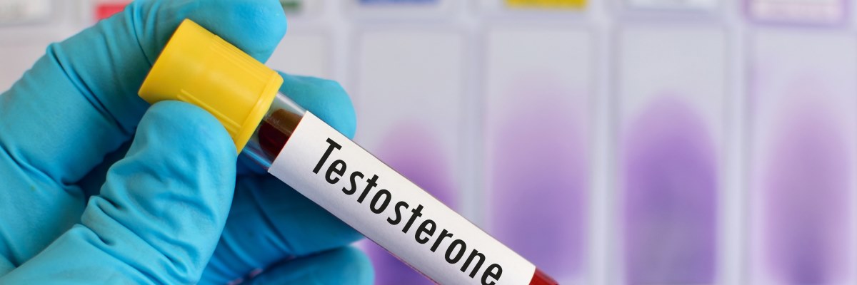 Attività fisica e calo del testosterone