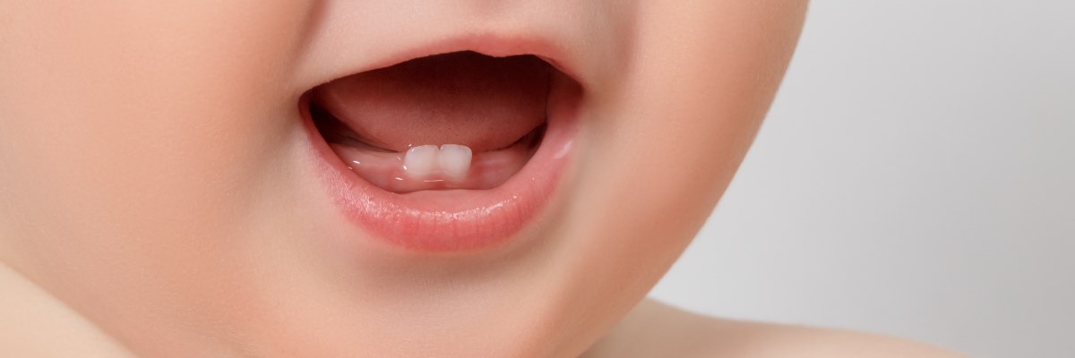Denti da latte e dolore gengivale, che fare?
