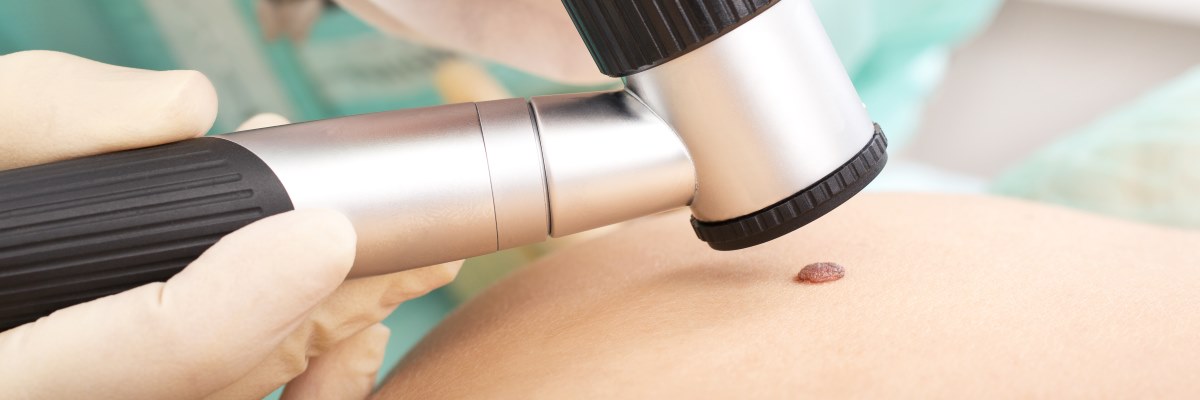 Melanoma: SuperAdo spiega ai bambini come sconfiggere Mel