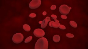Nuova terapia per il linfoma diffuso a grandi cellule B: intervista all'ematologo Zinzani