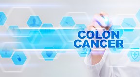 Cancro colon, attenzione ai cibi ultra-processati 