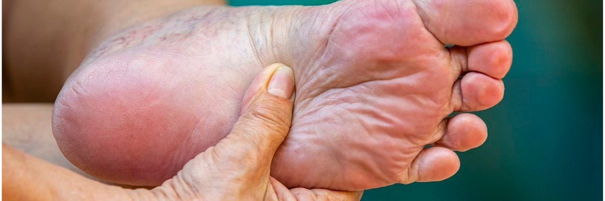 Rete Farmacie Apoteca Natura: al via la campagna per la prevenzione del piede diabetico