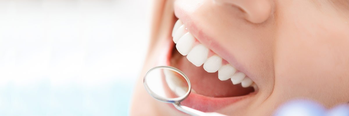 Patologie di bocca e denti